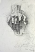Plaster arm