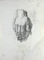 Plaster arm 2
